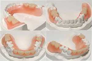 proteza-dentara (Demo)