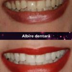 clinica stomatologica albire dentara bucuresti