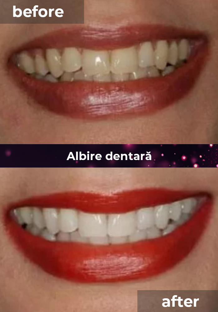 clinica stomatologica albire dentara bucuresti