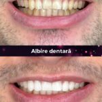 clinica stomatologica albire dentara bucuresti