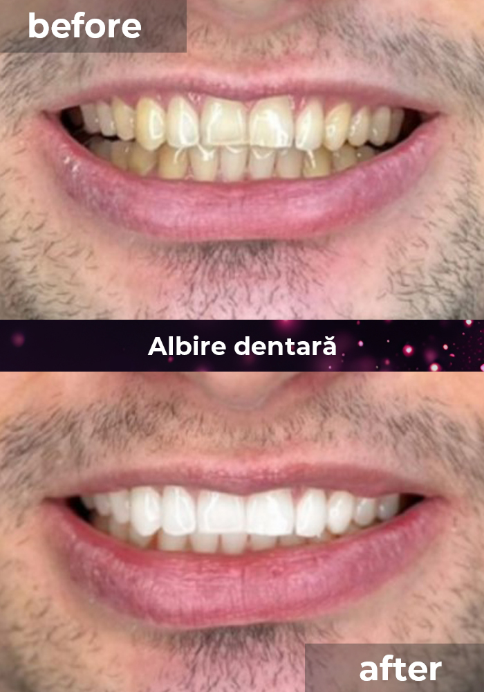 clinica stomatologica albire dentara bucuresti