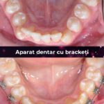 cea mai buna clinica aparat dentar bucuresti