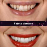 cea mai buna clinica fatete dentare bucuresti