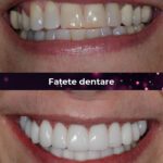 cea mai buna clinica fatete dentare bucuresti