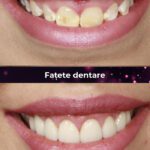 cea mai buna clinica fatete dentare bucuresti