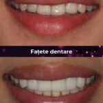 clinica fatete dentare