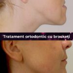 cea mai buna clinica aparate dentare bucuresti