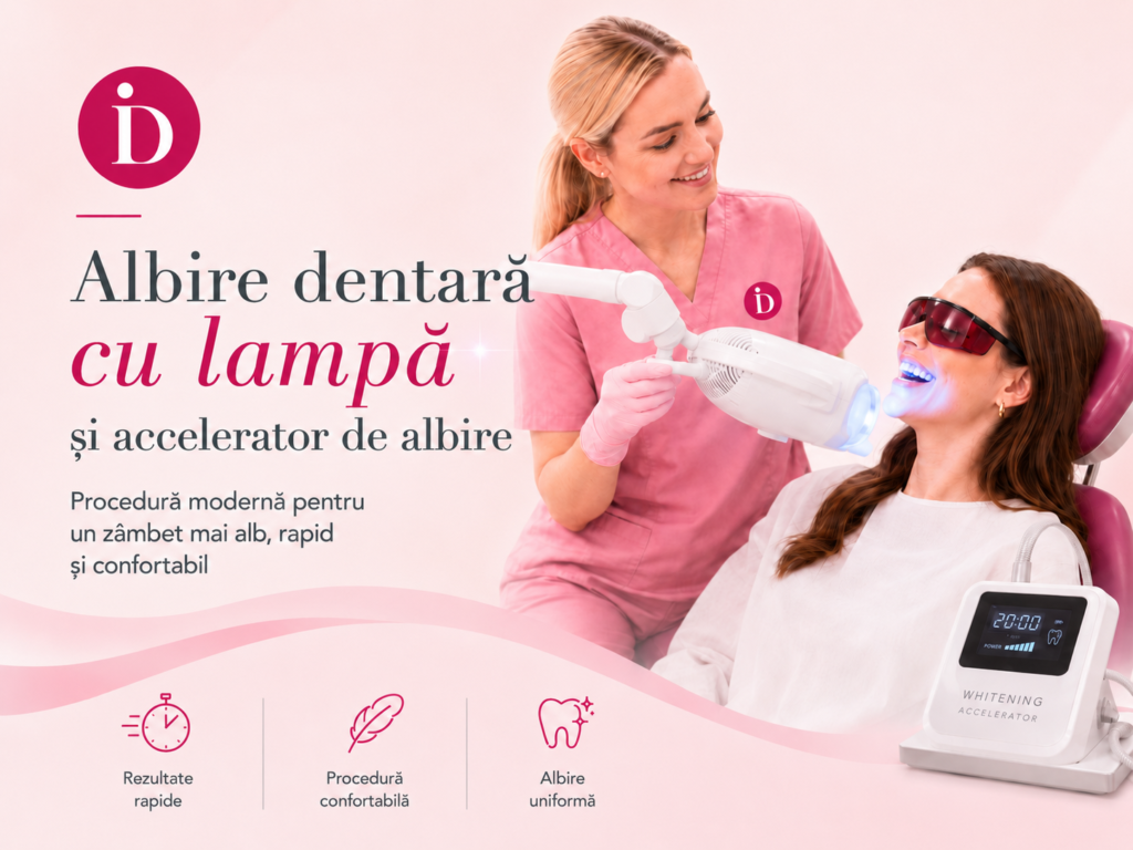 Albire dentară cu lampă și accelerator de albire