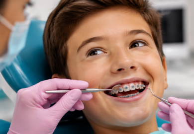 aparat dentar pentru copii Aparat dentar pentru copii: când este necesar?